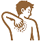 乾癬